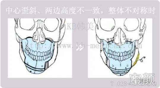 https://img.yiyiaimei.com/mnt/timg/200224/1401212A4-0.jpg