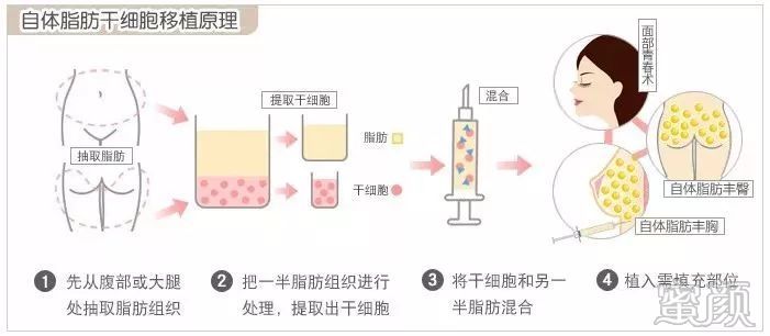 案例图片