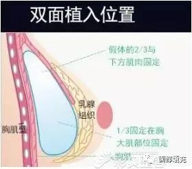 案例图片