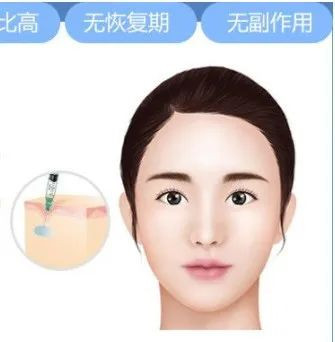 https://img.yiyiaimei.com/mnt/timg/200225/1350194343-0.jpg