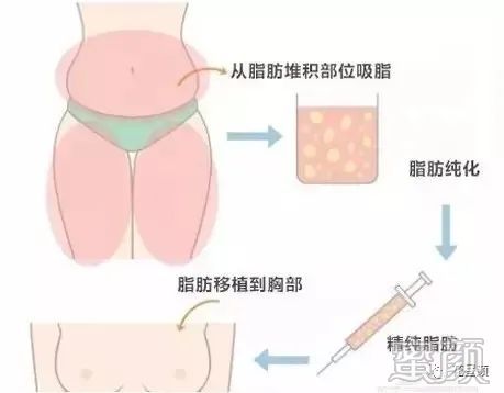 https://img.yiyiaimei.com/mnt/timg/200225/140KS207-0.jpg