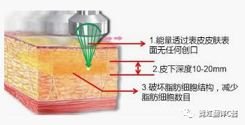 案例图片