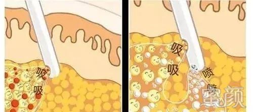 案例图片