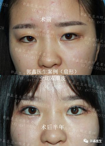 https://img.yiyiaimei.com/mnt/timg/200225/1439303104-12.jpg