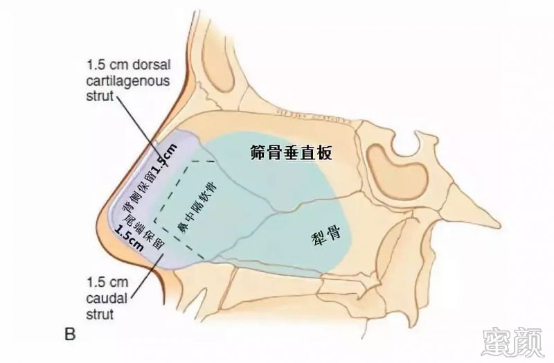 案例图片