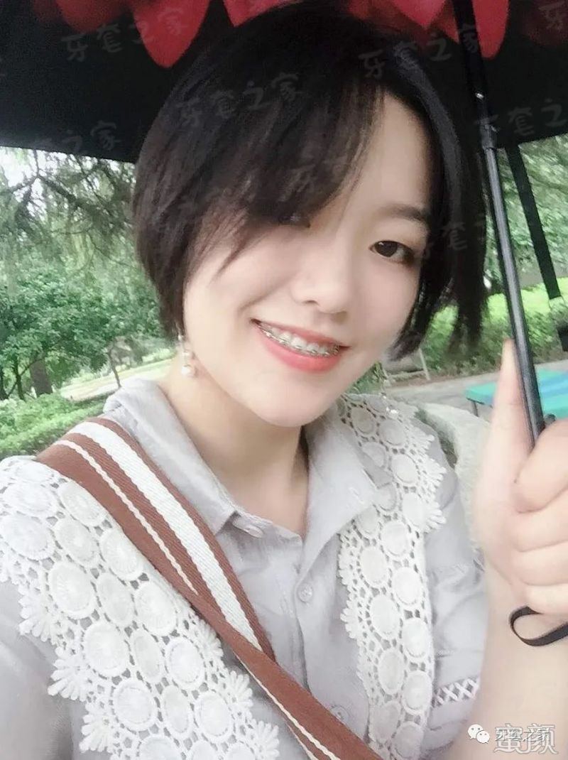 https://img.yiyiaimei.com/mnt/timg/200226/13062CS9-5.jpg