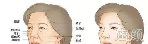 https://img.yiyiaimei.com/mnt/timg/200226/130R1J52-1.jpg