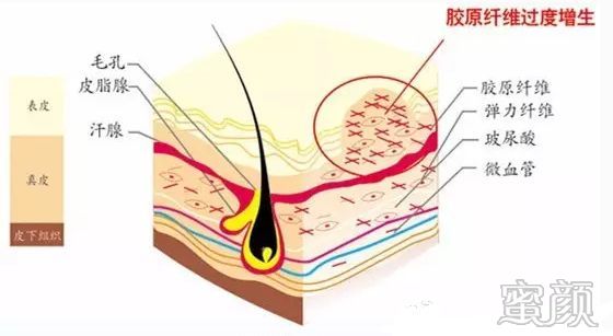 案例图片