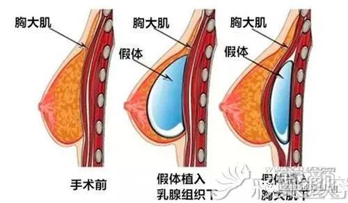 案例图片