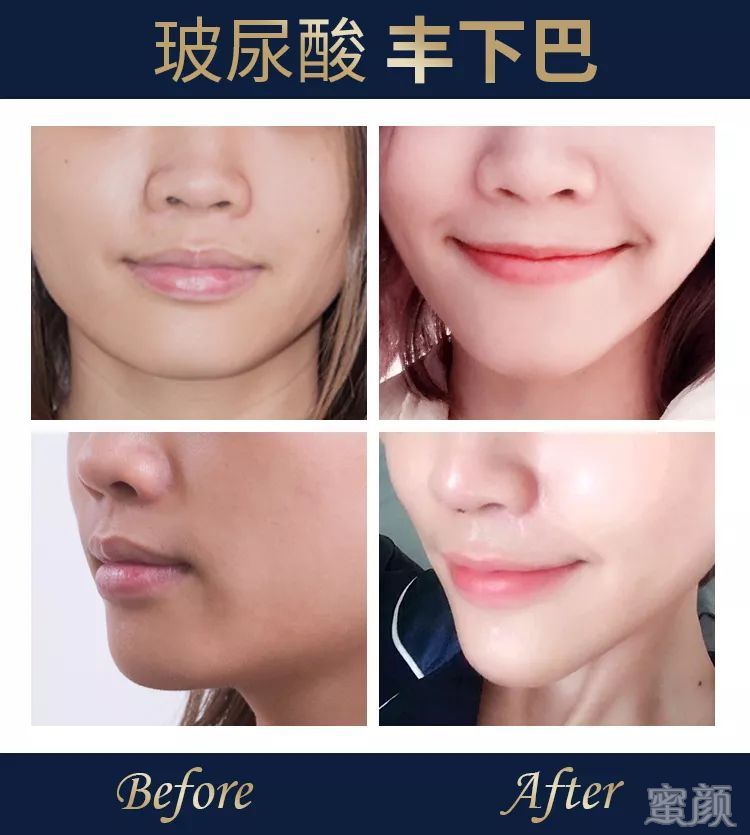 案例图片