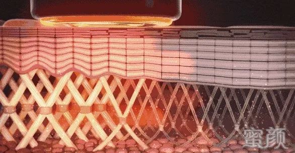 案例图片