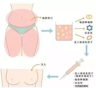 案例图片