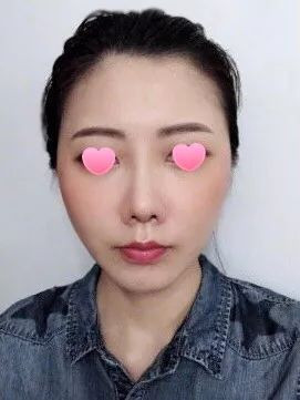 案例图片