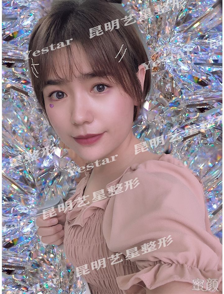 案例图片