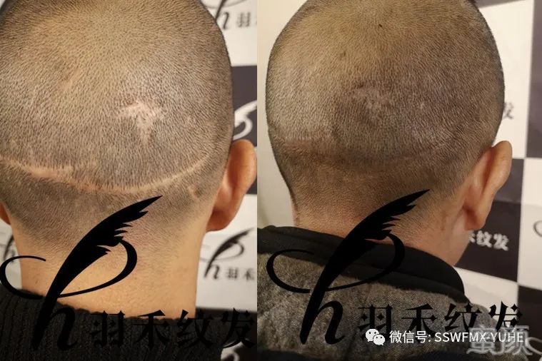 https://img.yiyiaimei.com/mnt/timg/200227/1442124a1-3.jpg