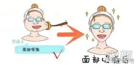 案例图片