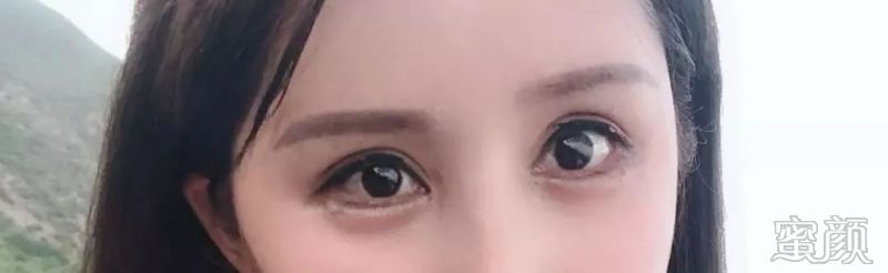https://img.yiyiaimei.com/mnt/timg/200228/124T94J9-0.jpg 案例图片