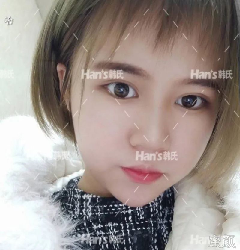 https://img.yiyiaimei.com/mnt/timg/200228/12594M3E-2.jpg 案例图片