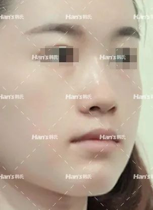 https://img.yiyiaimei.com/mnt/timg/200228/12594S043-4.jpg 案例图片
