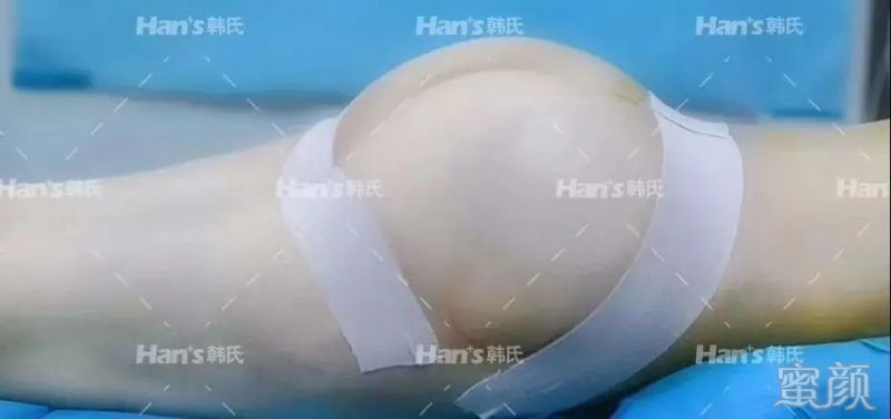 https://img.yiyiaimei.com/mnt/timg/200228/1259513932-9.jpg 案例图片