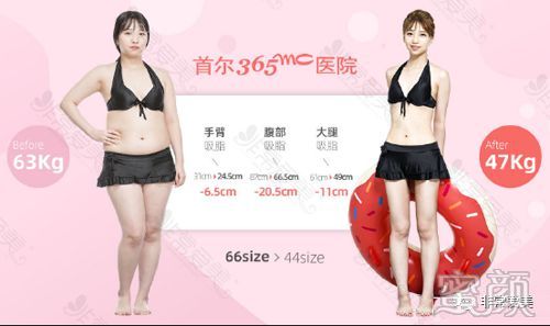 案例图片