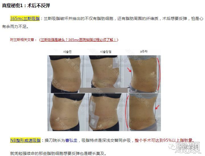 案例图片