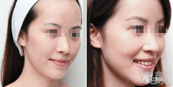 https://img.yiyiaimei.com/mnt/timg/200228/132P92913-4.jpg