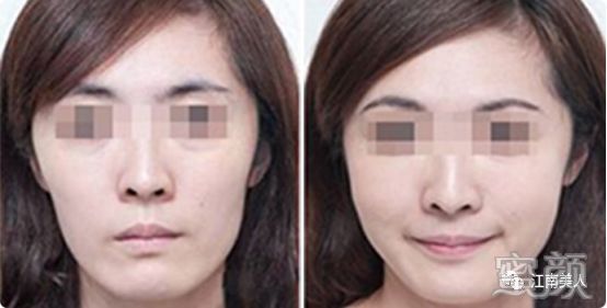 https://img.yiyiaimei.com/mnt/timg/200228/132PQ139-3.jpg