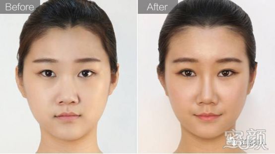 https://img.yiyiaimei.com/mnt/timg/200228/132PW463-2.jpg