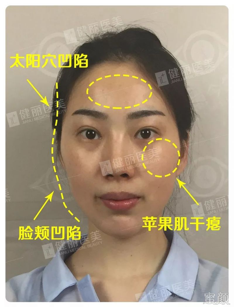 案例图片