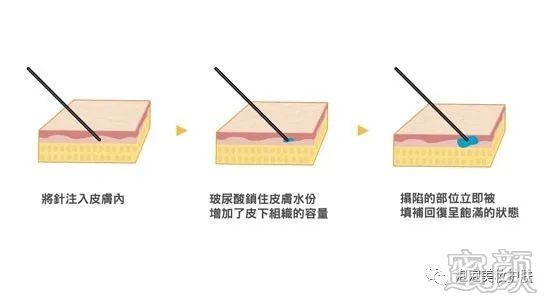 案例图片