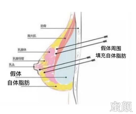 案例图片