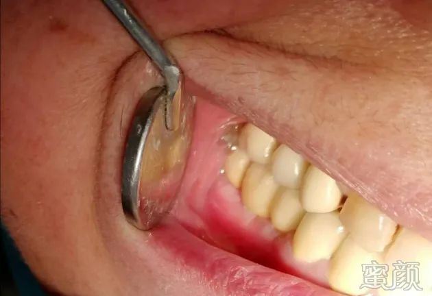 https://img.yiyiaimei.com/mnt/timg/200229/1452295452-9.jpg
