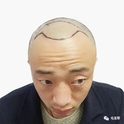 https://img.yiyiaimei.com/mnt/timg/200301/1205091022-0.jpg