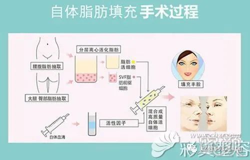 https://img.yiyiaimei.com/mnt/timg/200301/1229235054-1.jpg