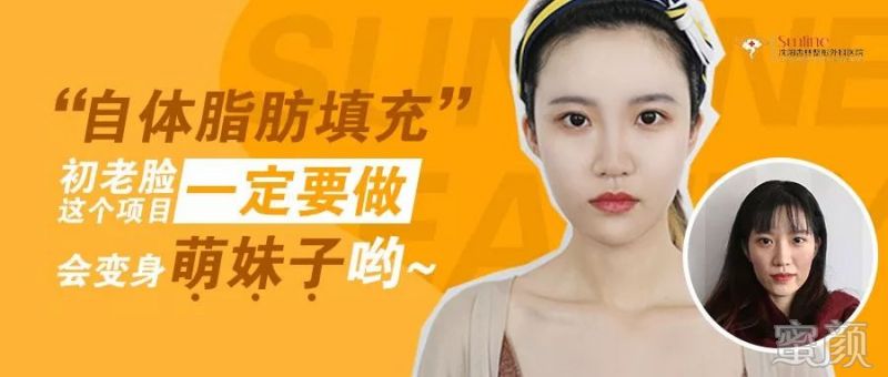 https://img.yiyiaimei.com/mnt/timg/200301/1251342113-2.jpg