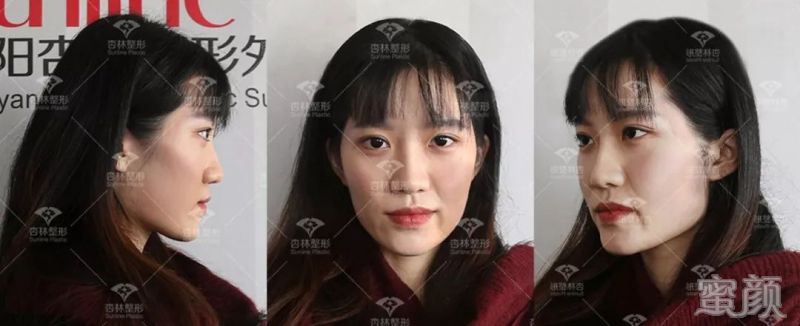 https://img.yiyiaimei.com/mnt/timg/200301/1251342A3-3.jpg