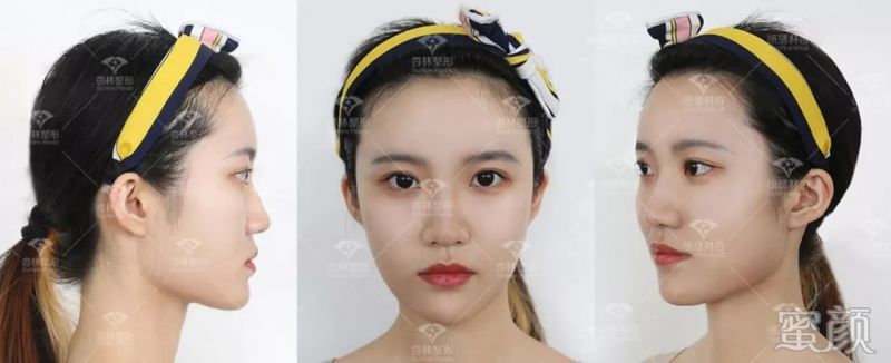 https://img.yiyiaimei.com/mnt/timg/200301/1251425494-8.jpg