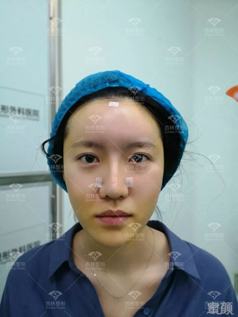 https://img.yiyiaimei.com/mnt/timg/200301/125142M52-7.jpg