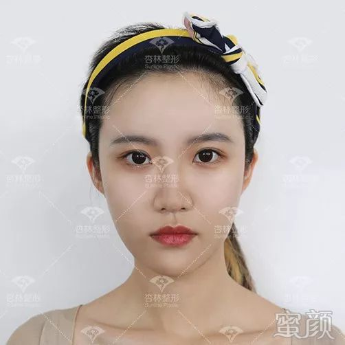 https://img.yiyiaimei.com/mnt/timg/200301/1251434346-9.jpg