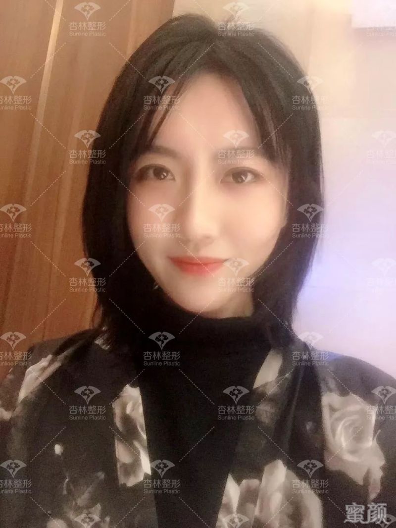 https://img.yiyiaimei.com/mnt/timg/200301/125143LK-10.jpg