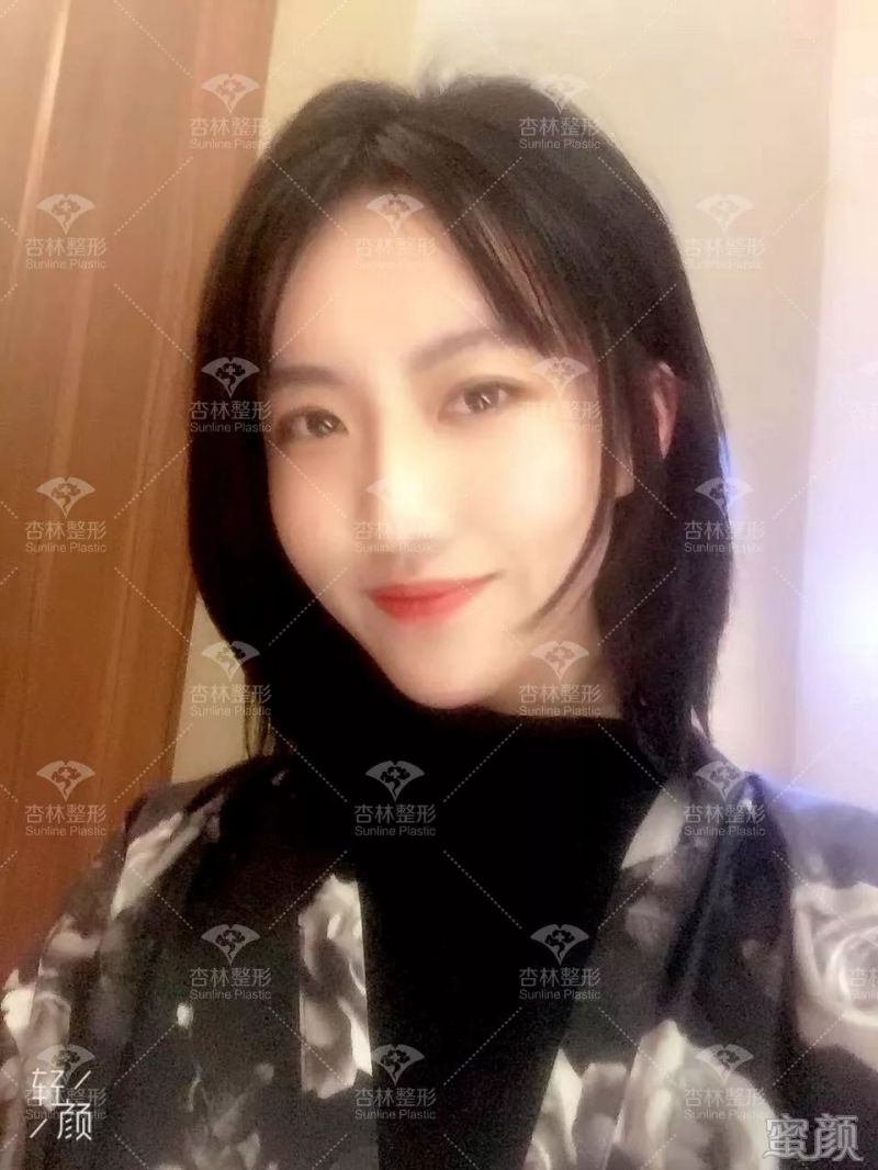 https://img.yiyiaimei.com/mnt/timg/200301/1251446210-11.jpg