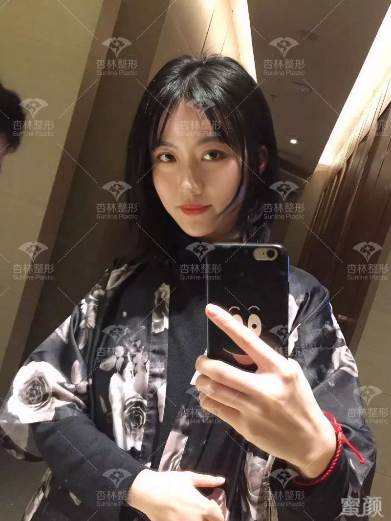 https://img.yiyiaimei.com/mnt/timg/200301/1251452X0-12.jpg