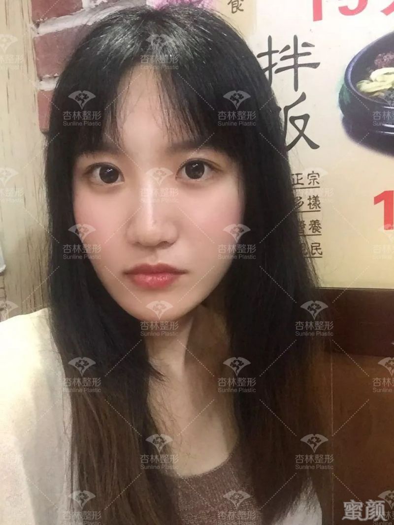 https://img.yiyiaimei.com/mnt/timg/200301/12514LA6-13.jpg