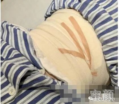 案例图片