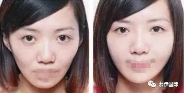 案例图片