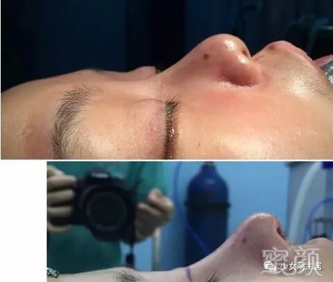 案例图片