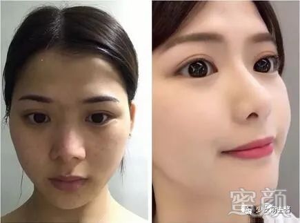 案例图片