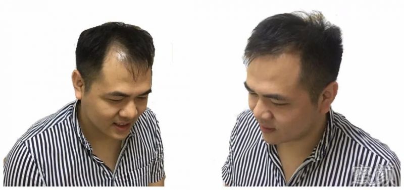 https://img.yiyiaimei.com/mnt/timg/200302/1402103104-0.jpg
