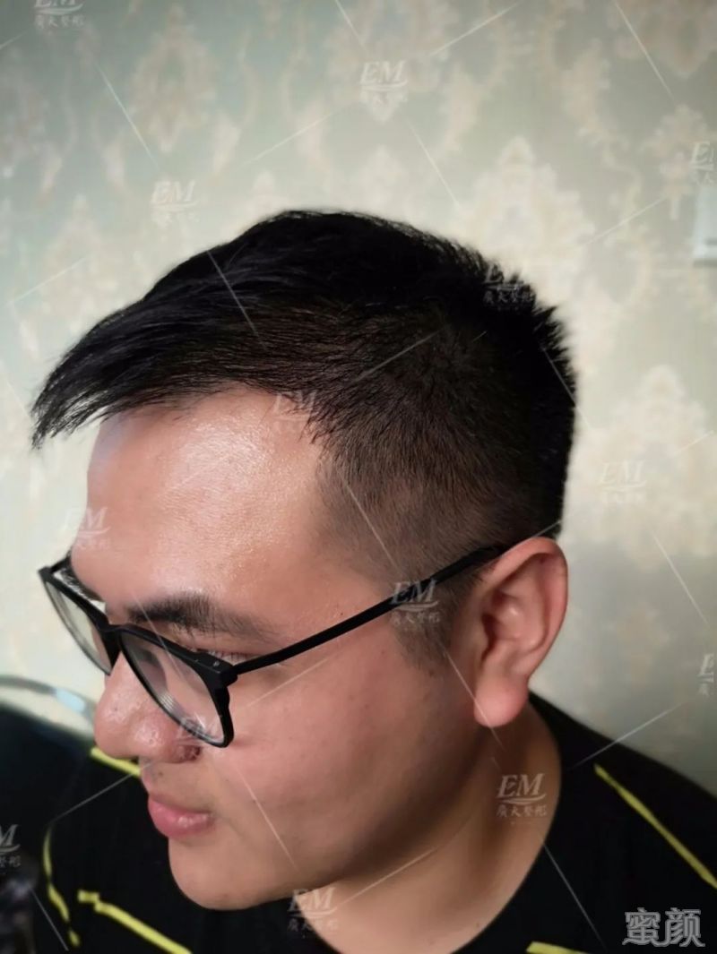 https://img.yiyiaimei.com/mnt/timg/200302/1402215X6-6.jpg